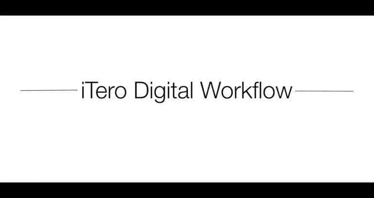 iTero Digital Workflow
