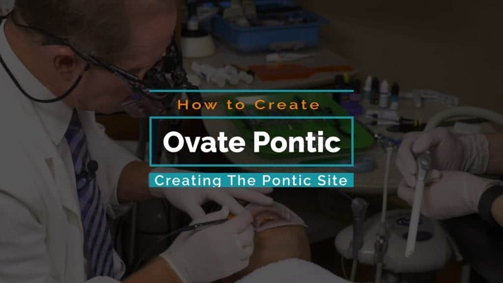 How To Create the Ovate Pontic Site Keating Dental Lab