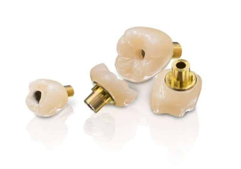 SRZ Dental Implants