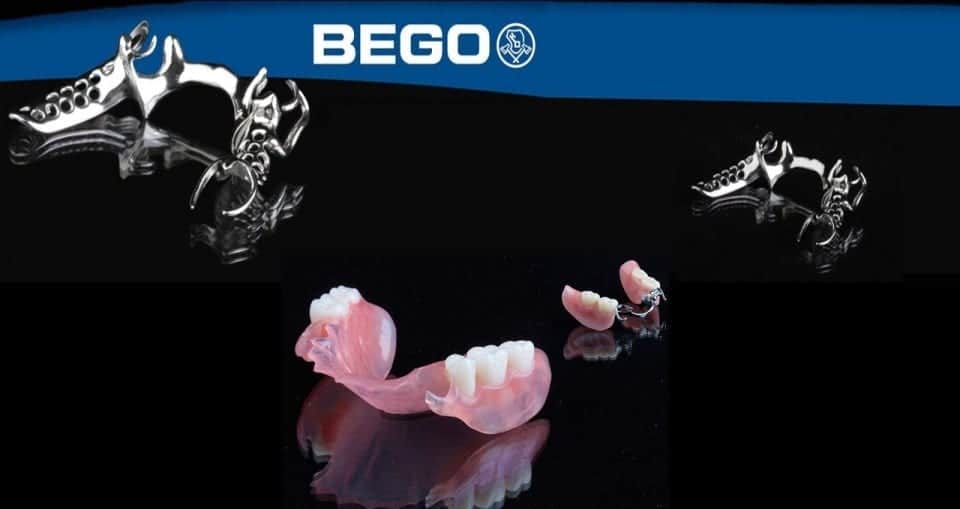 Bego® Cast Partials And Cast Frames Keating Dental Lab