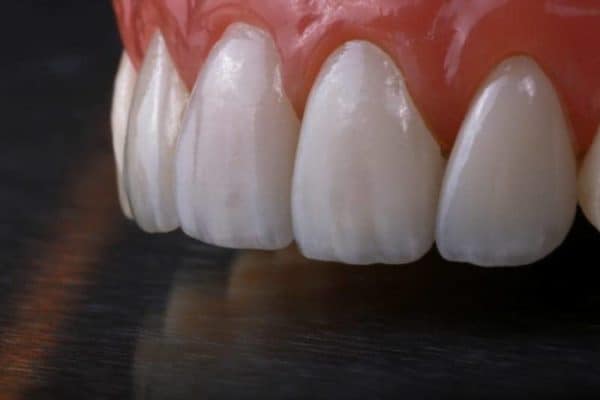 Full-Service Dental Lab | High-Quality Dental Lab Products