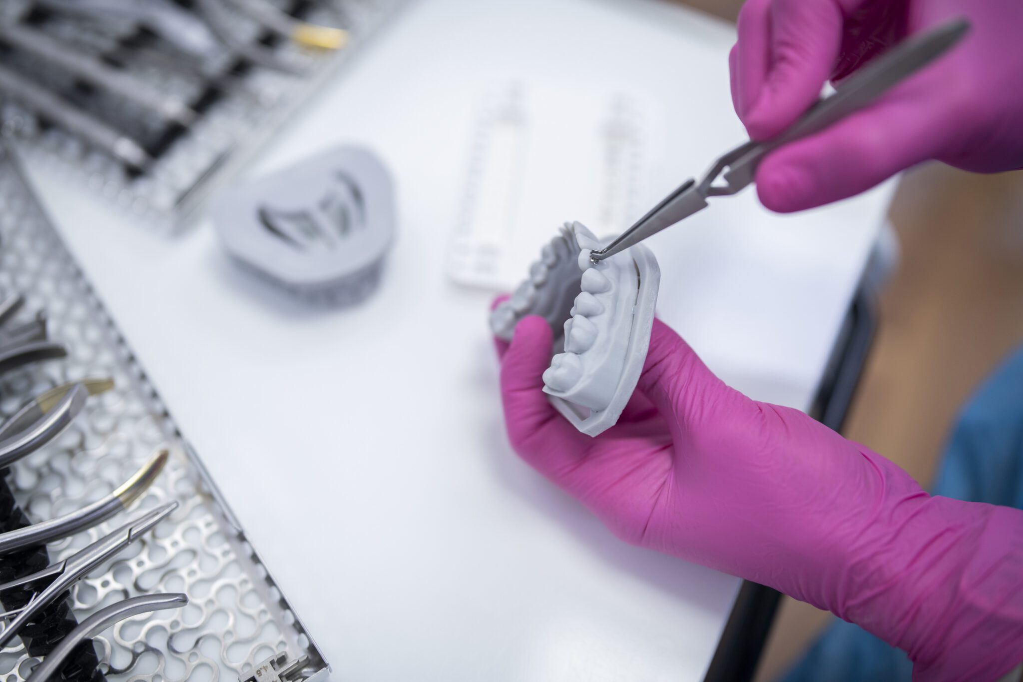 Orthodontist putting braces on a dental layout.