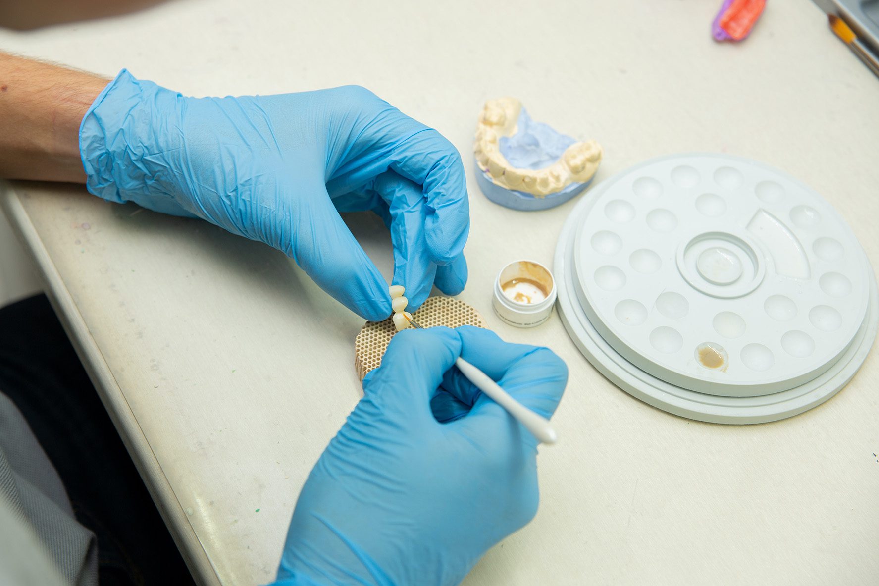 dental technician manipulating a implant-supported bridge in a dental laboratory