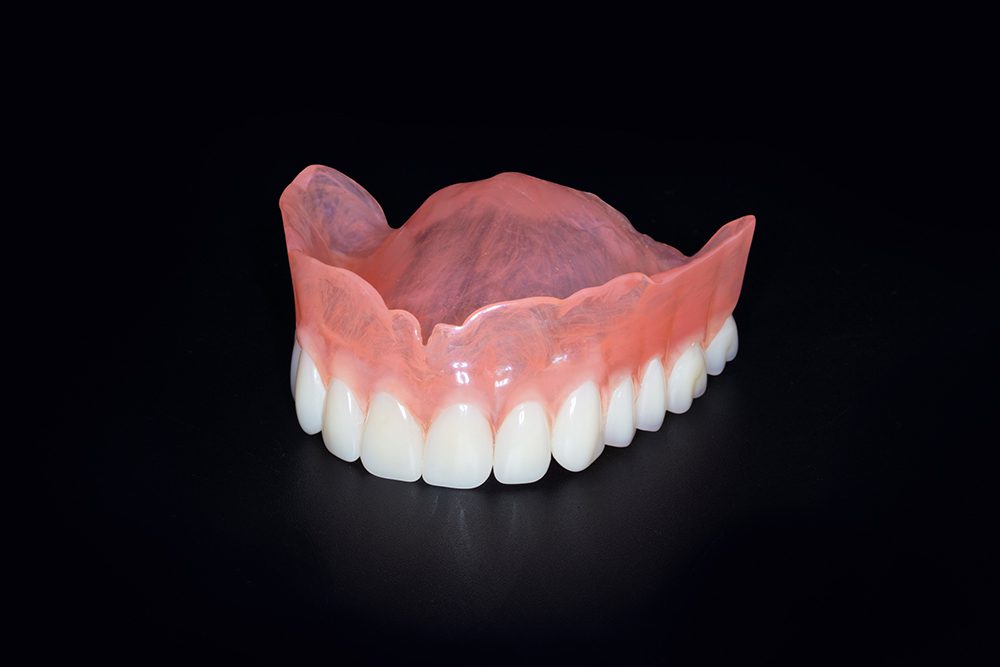 KDL Natural Denture Lab - Microcrystalline Polymer Denture