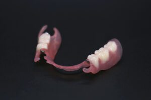 TCS partial denture with chrome rest seats over a black background