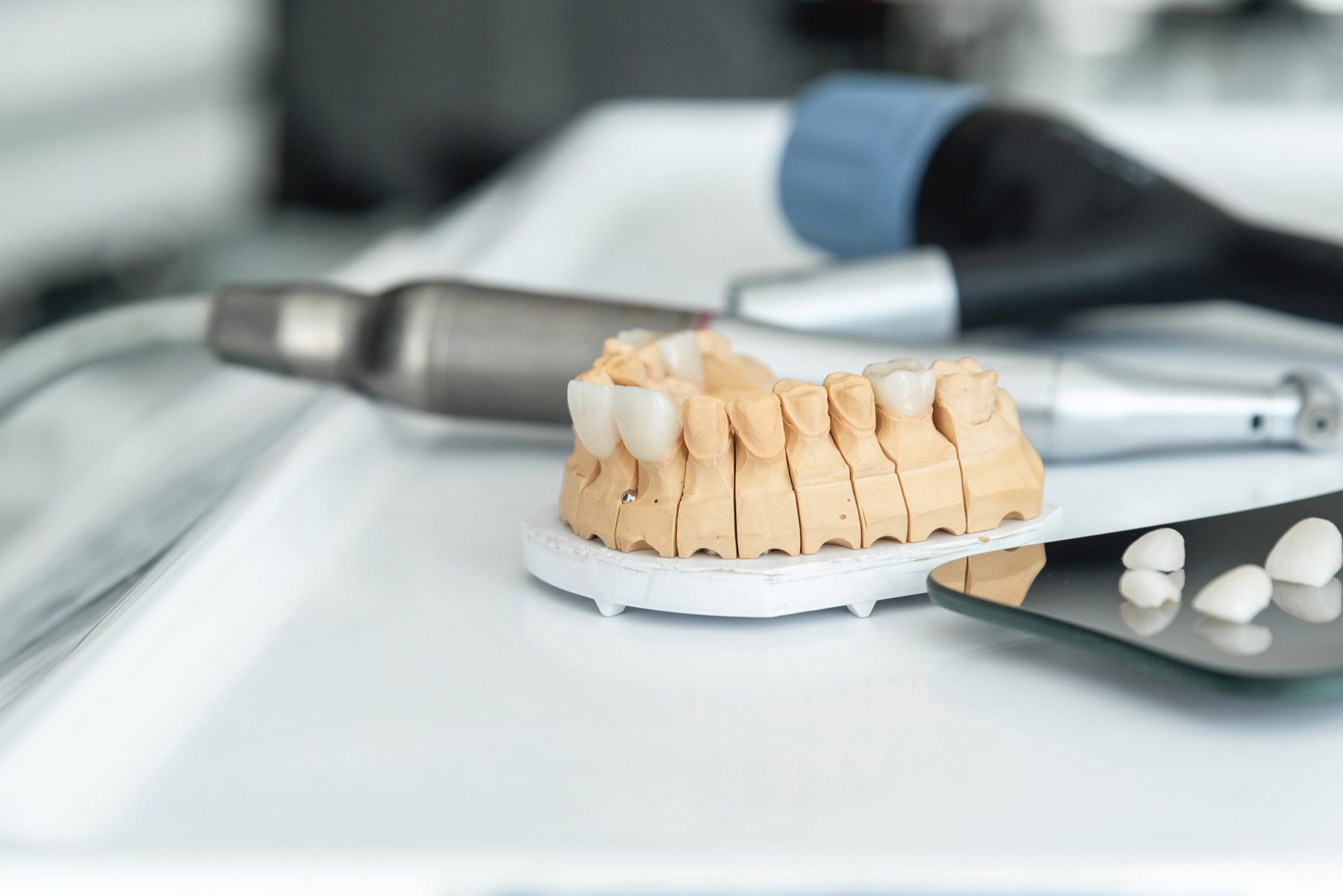 Artificial jaw with veneers and crowns, on the work table in the dental laboratory. Dentistry and treatment concept.