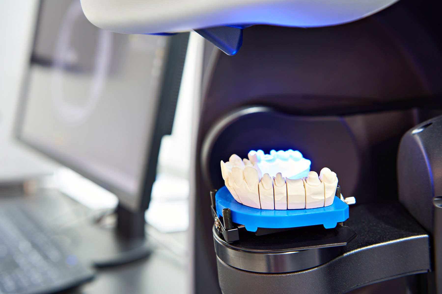 Modern extraoral laboratory dental scanner